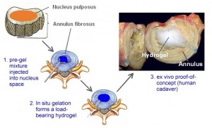 پلیمرها, مهندسی, پزشکی