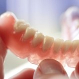 کامپوزیتی, دندانی